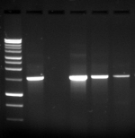 LOEWE Molecular Diagnostics - RNA PCR kits